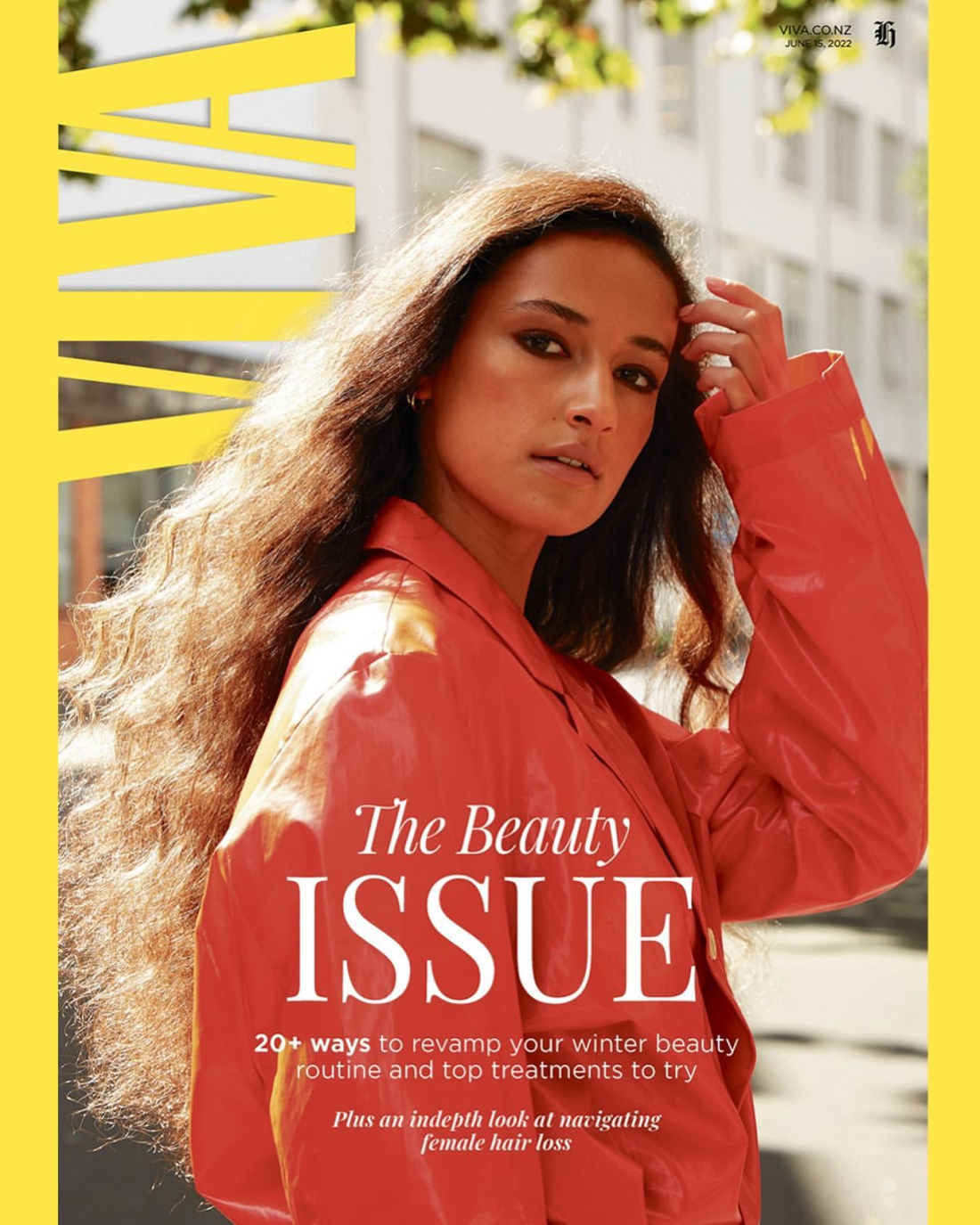 Alaina photographed for Viva Magazine by Marissa Findlay; H&M: Amber Lou Carroll